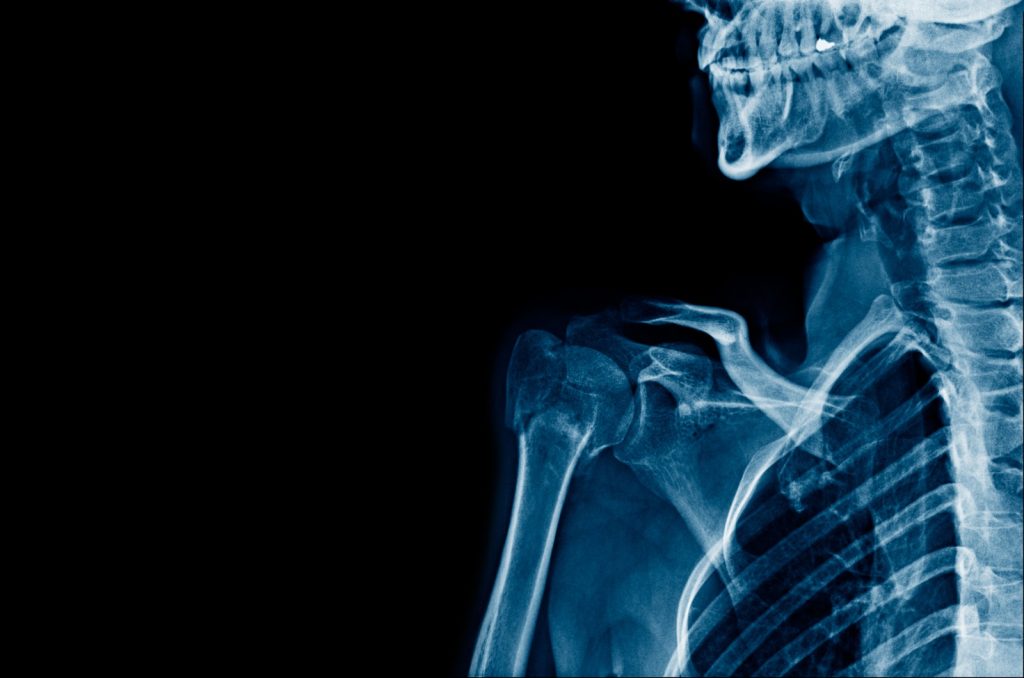 Blue skeleton